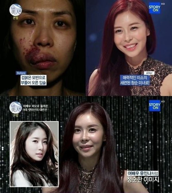 렛미인