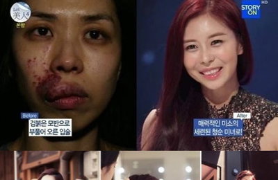 렛미인 김희은, 반쪽얼굴녀에서 유인나 닮은 미모로 '아름다운 웨딩화보'