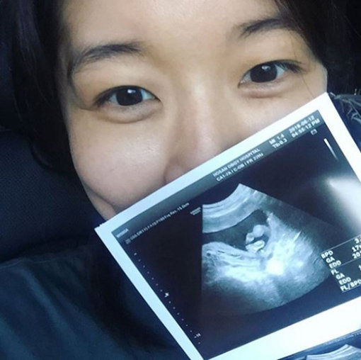 [사진]김빈우 SNS